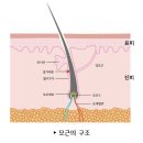 탈모퀸 이미지