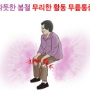 전방십자인대파열 수술후 재활운동의 중요성! 이미지