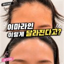 헤어 앤 피부샵 | 용산왁싱 뷔쥬아 왁싱앤피부 이태원본점 헤어라인 관리 리얼 후기