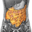 greater omentum(큰그물막) 이미지