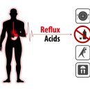 에이엔비 이미지