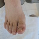 한국지엠장유바로서비스 | 김해 장유 내성발톱 닥터페디 김해진영점 만족스러운 관리 후기