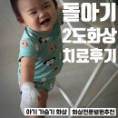 하나외과의원 | 11개월 아기 손바닥 가습기 화상입고 흔적 없이 치유했던 꿀팁 방출 새솔외과의원 치료 후기