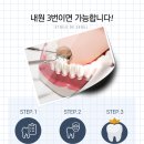 에투알드서울치과 네이버블로그