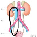 고환 및 우측 골반 통증을 콩팥으로 접근하면 어떨까요? 이미지