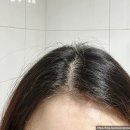 하움 PGGM 빠지지마 탈모 증상 완화 샴푸 2주 실사용 후기