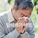 한양이비인후과의원 네이버블로그