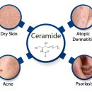 Re: 문치연 피부연고 탐구!! 피부층 세라마이드 합성 촉진 한약재!! 이미지
