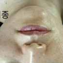 김포 임스테라피_게리종 후기