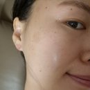 라온메디케어 이미지