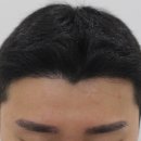 압구정맘모스헤어라인의원 이미지