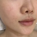 (주)드림노트엔터테인먼트 | [하남 올가드림뷰티] [PDRN 물광재생관리] 피부가 환해지는 디톡스 케어 후기