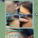[공지] 큐사랑 팡팡메디 에센스, 육모 특허 성분의 위력 머리나는 에센스