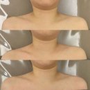 온하 | 김해 삼방동 온하에스테틱 등관리 승모근관리 후기