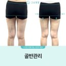 대구코스메틱 | 대구피부관리 고운빛깔에스테틱 대구점, 3D이목구비 관리가 만들어준 또렷한 윤곽 대구경락 대만족 후기