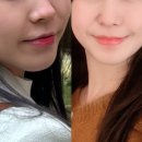 르씨엘의원 | [피부과｜웨딩 준비] 엘란쎄 (콜라겐으로 예쁨 얻기 in 대구)