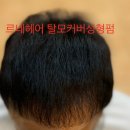 르네시떼 이미지