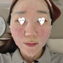 레드튠 | 청담피부과 튠페이스 레드 내돈내산 후기 (+ 유지기간, 주기, 가격, 효과)