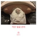 신라약손