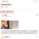 명광전기 | 가슴밑빠짐 재수술? 겨절/밑절에 따른 방식 총정리 <20년의 연구 경험을 드리는 조언>