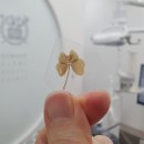 클로버치과의원 네이버블로그