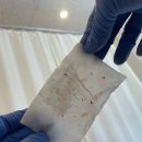 더고운피부 | [별내]별내별가람역 압출 맛집 아이고운피부 내돈내산 방문후기