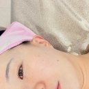 앤바이오 | 달서구피부관리 바디앤스킨 바이오필링 후기