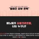 역삼바노바기성형외과 네이버블로그