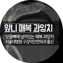 성산2교(상)