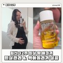 11545-10-28-32 | 임신 32주 임산부 증상 : 배크기 및 튼살 관리 &amp; 역아돌리기 성공 태동 위치 변경