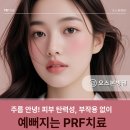 오스본병원 | 주름 안녕! 피부 탄력성, 부작용 없이 예뻐지는 PRF치료 [산본 오스본병원]