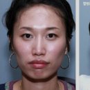 서울제일성형외과의원 이미지