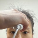[신용산역피부과] 기미잡티레이저 5회 &#39;피코토닝&#39; 효과 솔직후기 (+피부과 비타민관리)