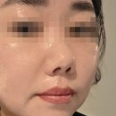 윙밸스킨