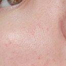 코슈마드 | 내돈내산 싸이토케어 앰플 홈케어 당장하세요 진짜..