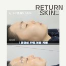 리턴스킨 | 🌷 산본 리턴스킨 "페이셜 탄력·볼륨케어 관리 후기 "🌷