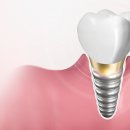 이플랜치과의원 이미지