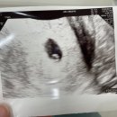 [임신일기 3탄] 16주 정기검사! 성별확정! 다양한 태아성별 테스트 결과는?!