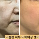 더플랜디