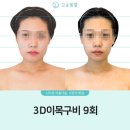 고운힐링팜 | 고운빛깔에스테틱대구점 대구피부관리 후기, 웨딩관리까지 믿고 맡긴 이유