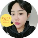 하길 | [눈밑지 리얼후기] 눈밑지방재배치 리얼후기 하길 잘했다!!