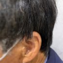 포낙보청기 이미지