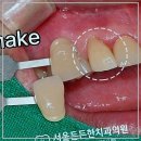 든든한치과의원 | 스케일링 잘하는 군자역 치과, 서울든든한치과 후기