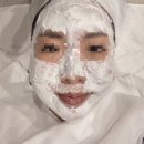 닥터신베스트의원 | 건대ㅡ닥터에버스의원 포텐자 2회차 (내돈내산),4일차 사진 포함