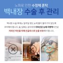 아이준안과 이미지