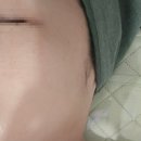 모이라이 | 탕정역 윤곽관리 전문점 &#39;모이라이뷰티&#39;에서 아이볼테라피 받은 후기 (IVOL)