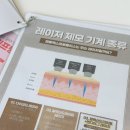 젠틀M헤어감정동점 | 구로피부과 얼굴 솜털 레이저제모 2회차 후기