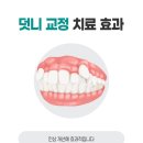 횡성치과의원 네이버블로그