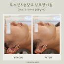 뷰스킨&숲칼프김포