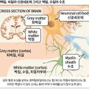 관상동맥 석회화와 우울증 이미지